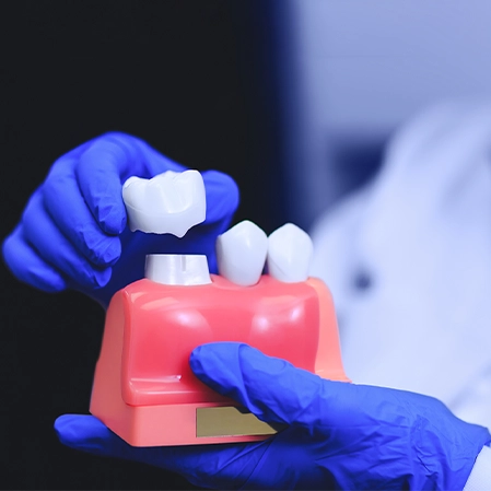 Gloved hands showing a plastic model of a jaw depicting a crown being laid onto a tooth